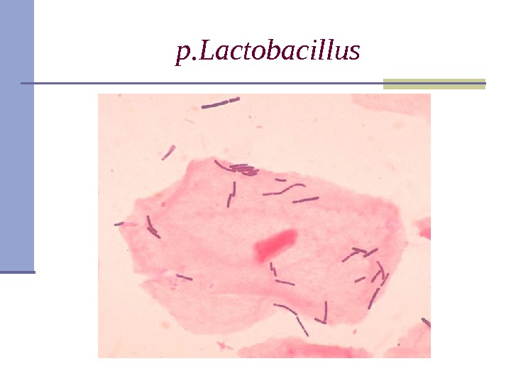 p. Lactobacillus 