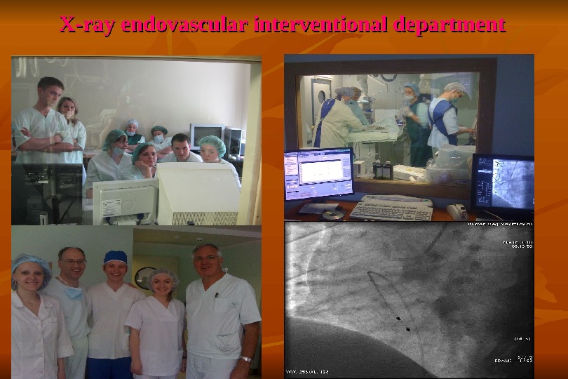 X-ray endovascular interventional department 