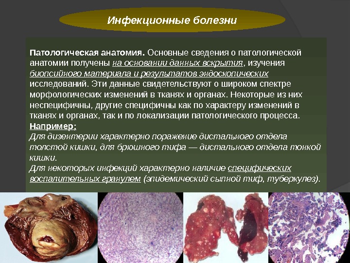 Инфекционные болезни Патологическая анатомия.  Основные сведения о патологической анато мии получены на основании