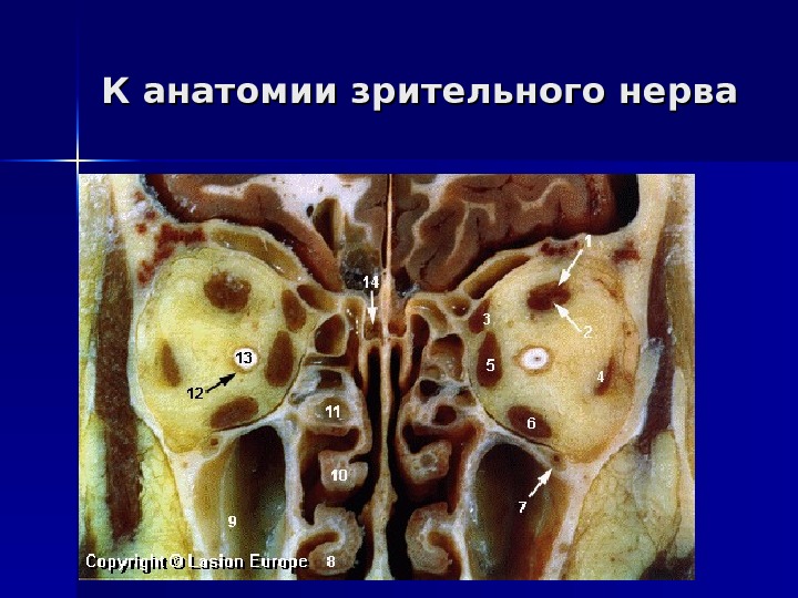 К анатомии зрительного нерва 