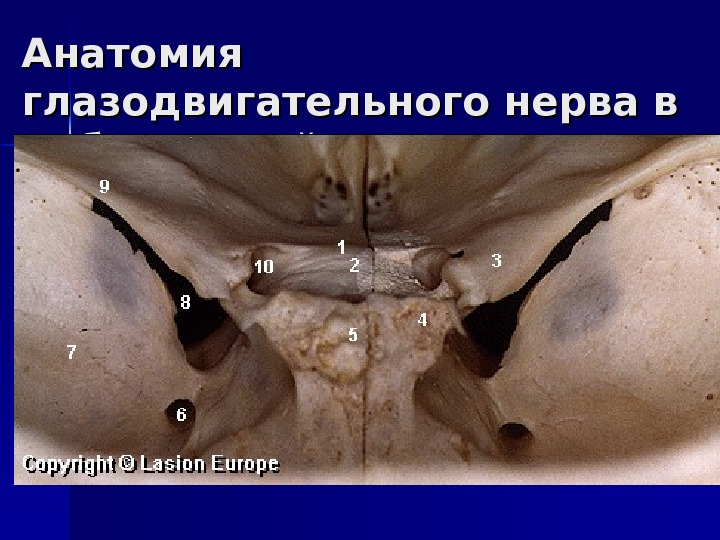 Анатомия глазодвигательного нерва в орбитальной щели 