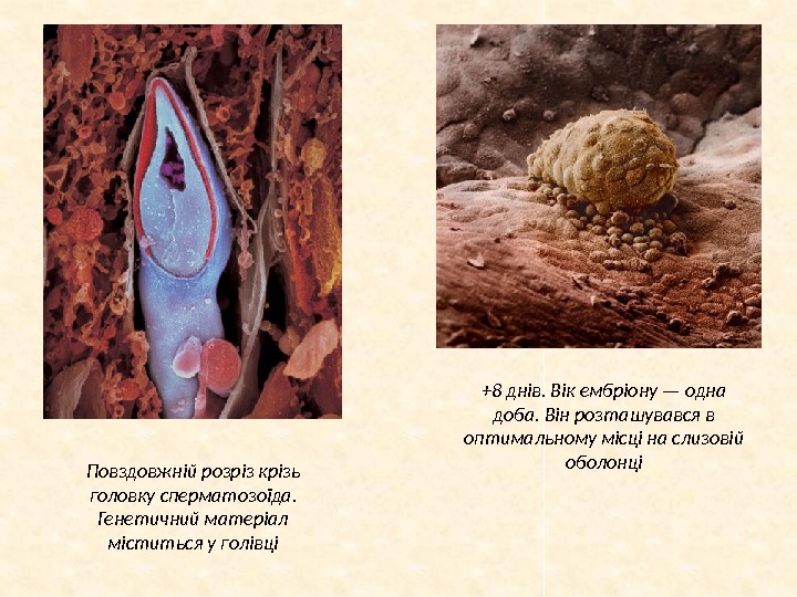 Повздовжній розріз крізь головку сперматозоїда.  Генетичний матеріал міститься у голівці +8 днів. Вік