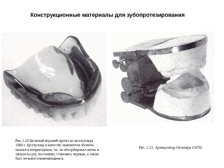 Конструкционные материалы для зубопротезирования Рис. 1. 20 Цельный верхний протез из целлулоида 1880 г.