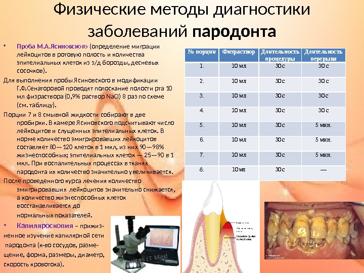 Физические методы диагностики заболеваний пародонта • Проба М. А. Ясиновского (определение миграции лейкоцитов в