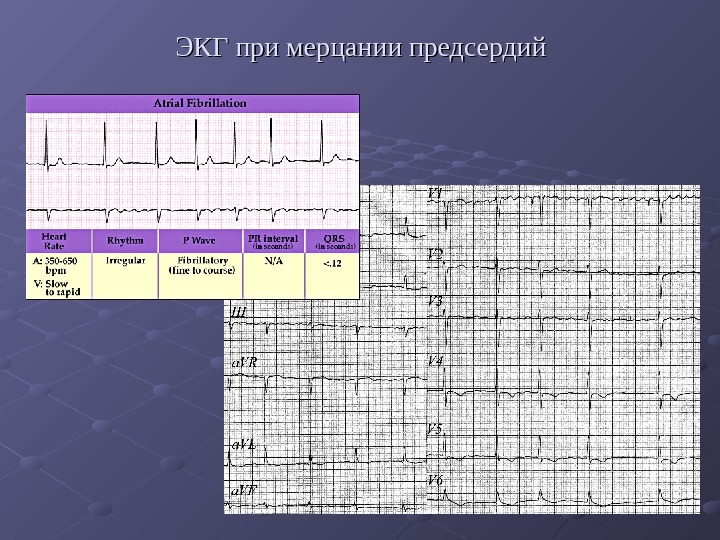 Субэндокардиальная ишемия передней стенки что это