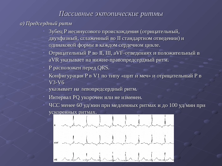   Пассивные эктопические ритмы    а) Предсердный ритм • Зубец P