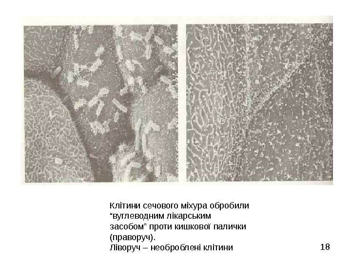   18 Клітини сечового міхура обробили “вуглеводним лікарським засобом” проти кишкової палички (праворуч).