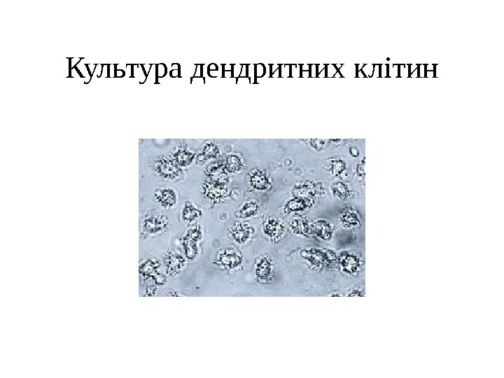 Культура дендритних клітин 