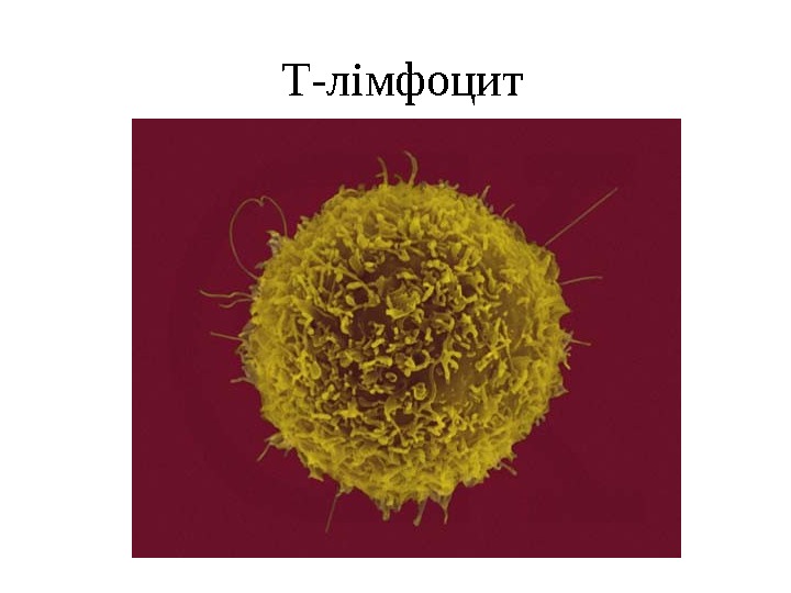 Т-лімфоцит 