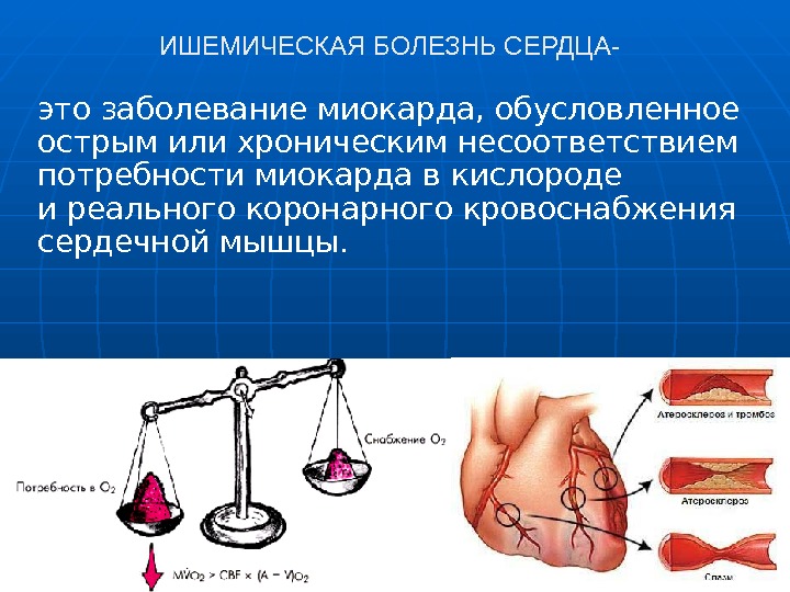 ИШЕМИЧЕСКАЯ БОЛЕЗНЬ СЕРДЦА- это заболевание миокарда, обусловленное острым или хроническим несоответствием потребности миокарда вкислороде