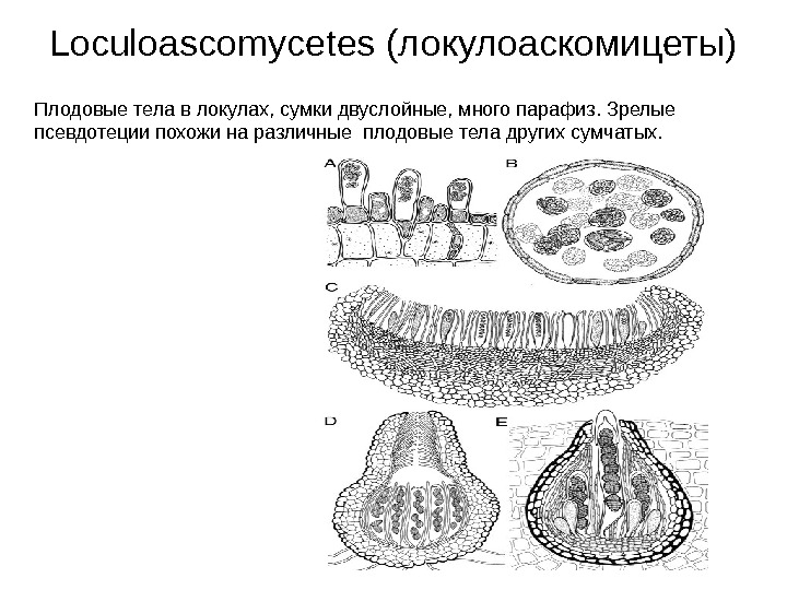   Loculoascomycetes (локулоаскомицеты)  Плодовые тела в локулах, сумки двуслойные, много парафиз. Зрелые
