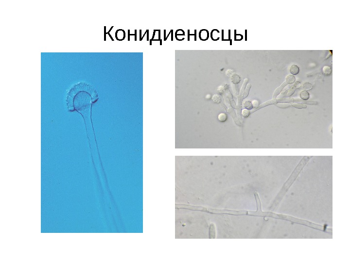  Конидиеносцы 