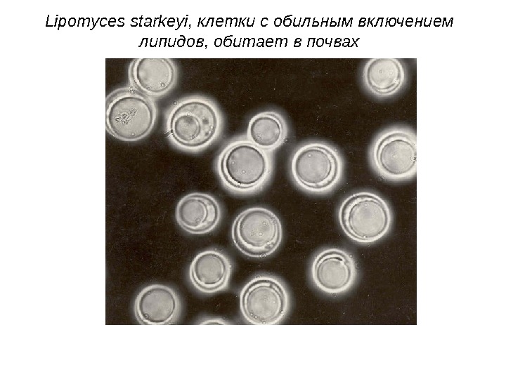   Lipomyces starkeyi , клетки с обильным включением липидов, обитает в почвах 