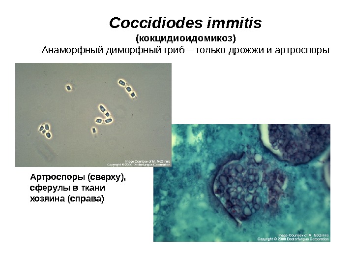   Coccidiodes immitis (кокцидиоидомикоз) Анаморфный диморфный гриб – только дрожжи и артроспоры Артроспоры