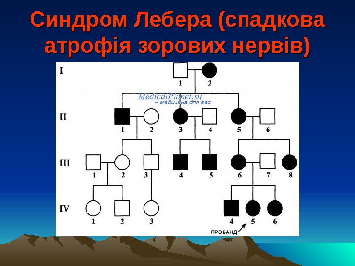 Синдром Лебера (спадкова атрофія зорових нервів) 