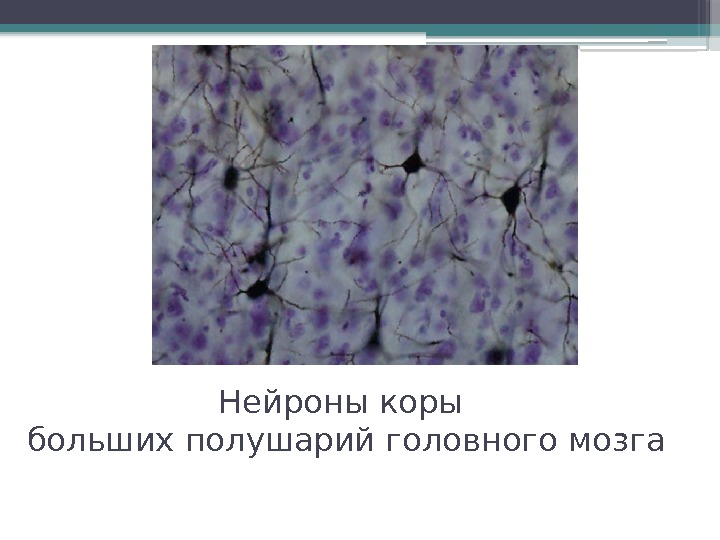 Нейроны коры больших полушарий головного мозга     