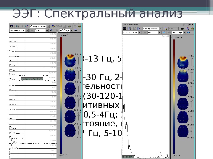 ЭЭГ: Спектральный анализ • Альфа-ритм (8 -13 Гц, 5 -100 мк. В) - ритм