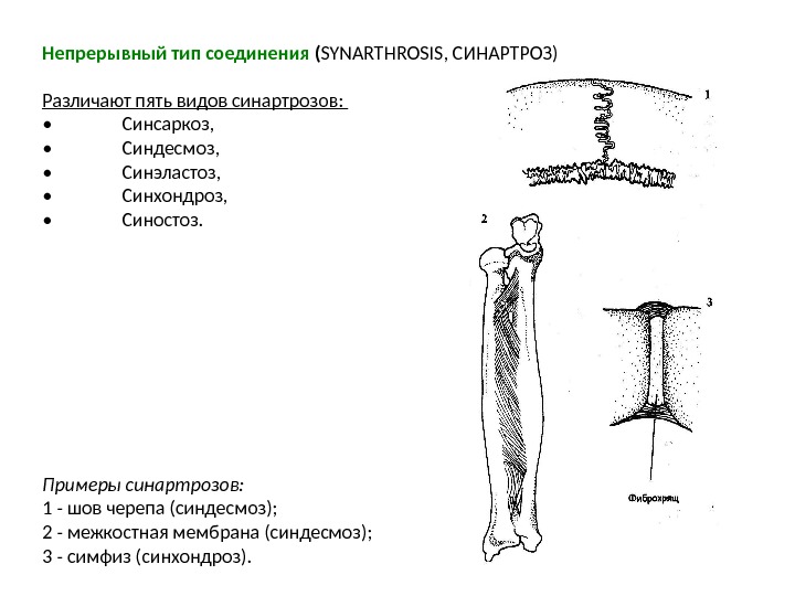 Непрерывным вид. Непрерывное соединение костей синдесмозы. Синхондроз синостоз синдесмоз синсаркоз. Схема соединения костей синартроз-непрерывные соединения. Непрерывные соединения костей примеры.