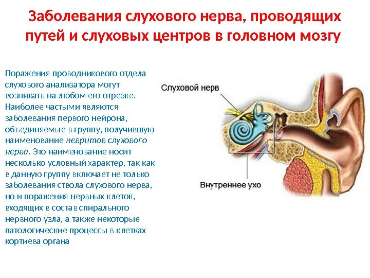Заболевания слухового нерва, проводящих путей и слуховых центров в головном мозгу Поражения проводникового отдела слухового анализатора