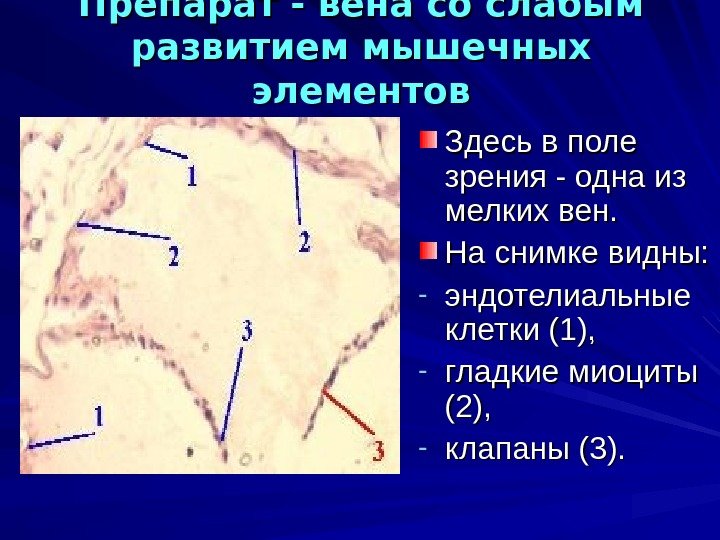 Вена препарат. Вена со слабым развитием мышечных элементов. Вена со слабым развитием мышечных элементов препарат. Вены со слабым развитием мышечных элементов характеризуются. Вена со слабым развитием мышечных элементов функции.