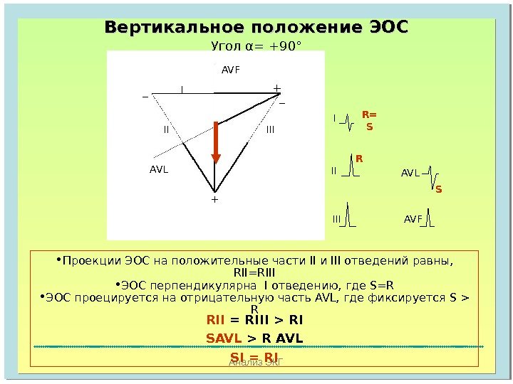 Анализ ЭКГВертикальное положение ЭОС  Угол α =  +90 °  AVF AVL II IIII