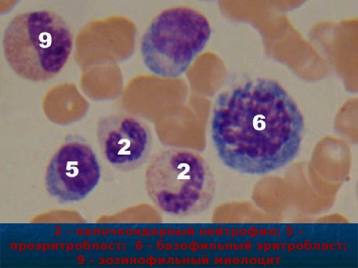   2 - палочкоядерный нейтрофил; 5 – проэритробласт; 6 - базофильный эритробласт;  9 -