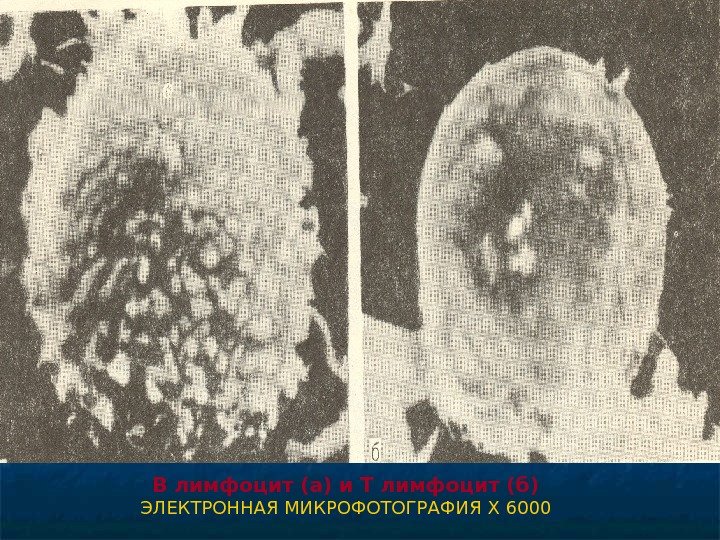   В лимфоцит (а) и Т лимфоцит (б)  ЭЛЕКТРОННАЯ МИКРОФОТОГРАФИЯ X 6000 