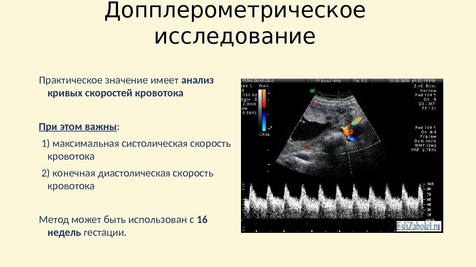 Сальпингоофорит карта вызова