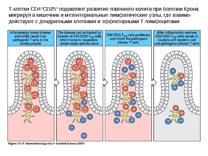 Т-клетки CD 4 + CD 25 +  подавляют развитие язвенного колита при болезни Крона мигрируя