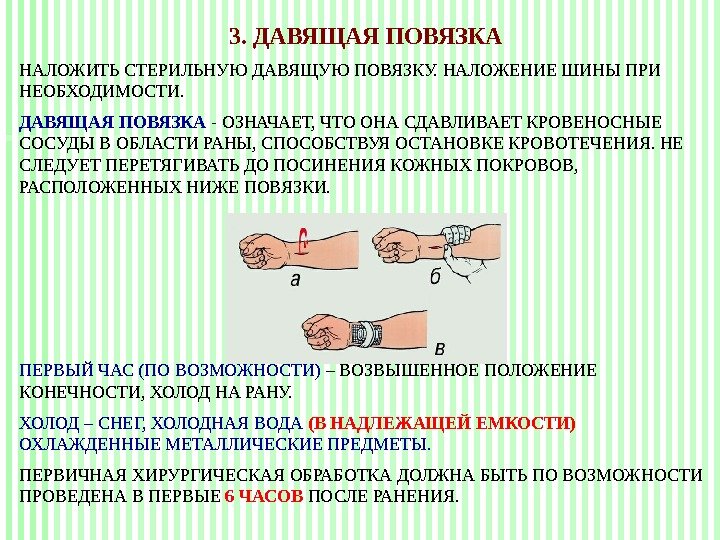 Наложение давящей повязки картинки