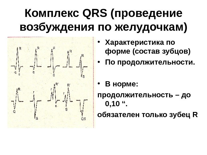 Комплекс qrs