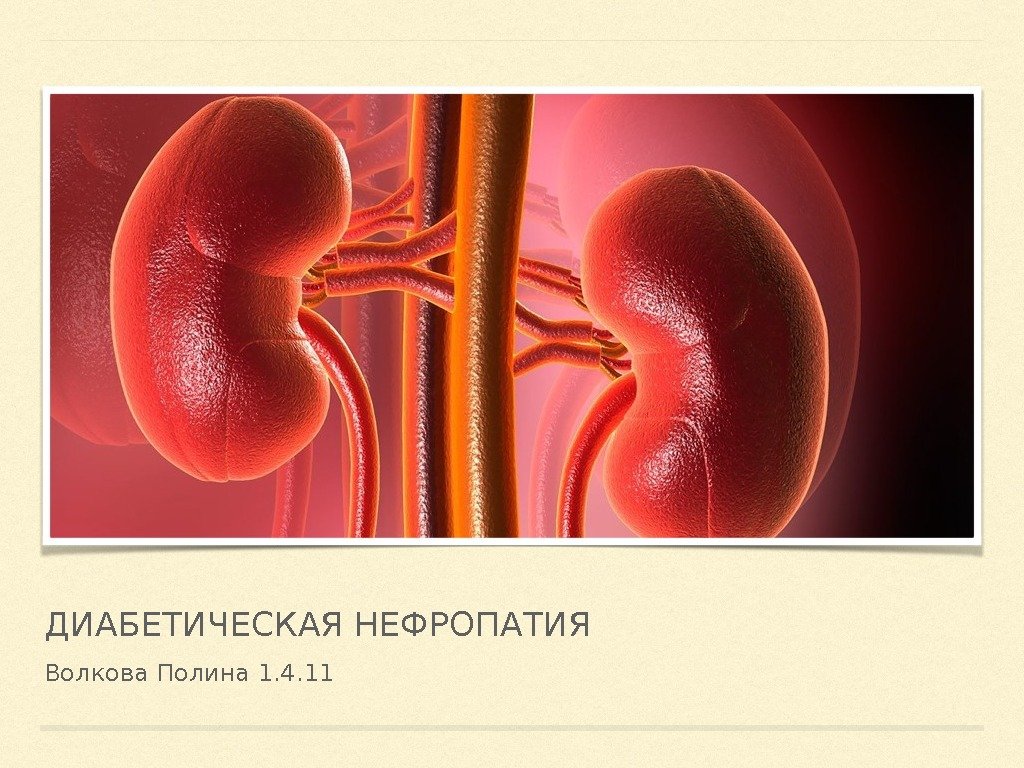 Диабетическая нефропатия. Диабетическая нефропати. Диабетическая нефропатия с3а а3. Мочекислая нефропатия. Диабетическая нефропатия презентация.