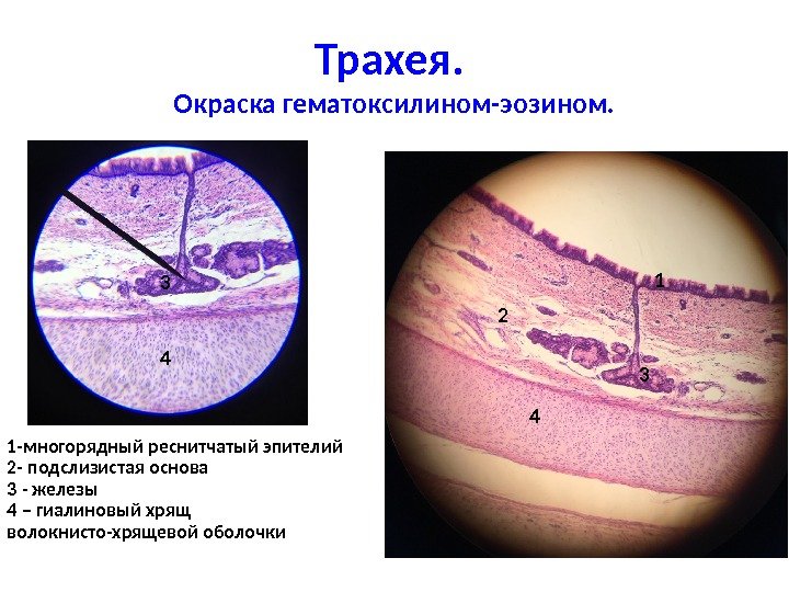 Трахея препарат гистология рисунок с подписями