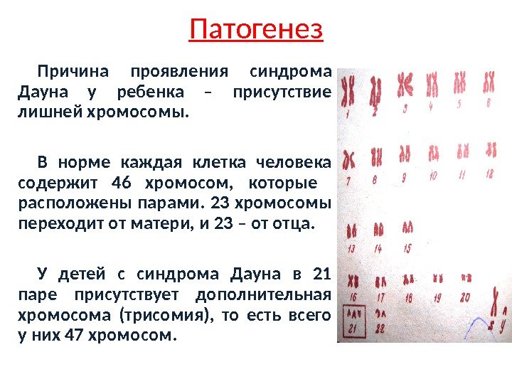 Сколько хромосом содержится в гаметах. 46 Хромосом у человека. Причины появления лишней хромосомы.