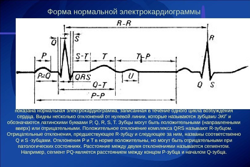 Рисунок экг физиология