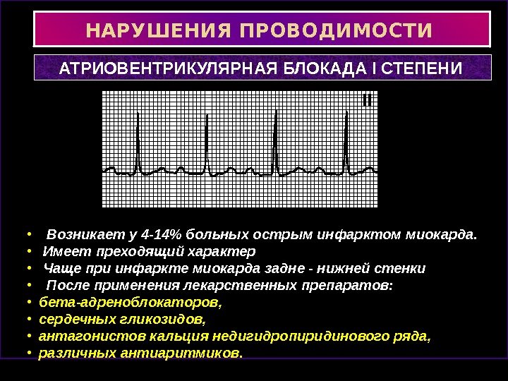 Местная внутрижелудочковая блокада на нижней стенке лж