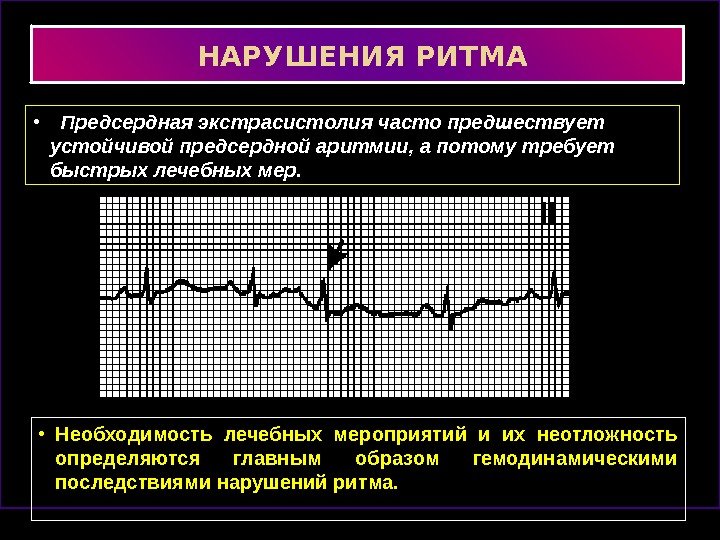 Экстрасистолия сердца что. Предсердная экстрасистолия причины. Предсердная экстрасистолия пульс. Пробежка предсердной экстрасистолии. Аллоритмическая экстрасистолия.