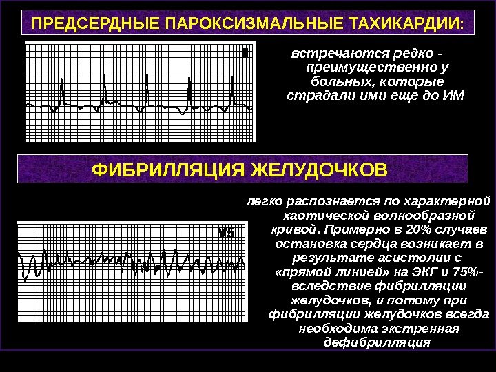 Пароксизмальная тахикардия презентация