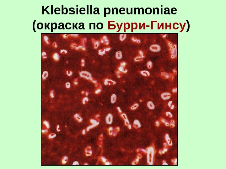 Klebsiella pneumoniae  (окраска по Бурри-Гинсу ) 