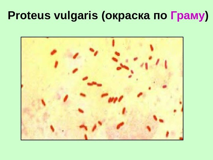 Proteus vulgaris (окраска по Граму ) 