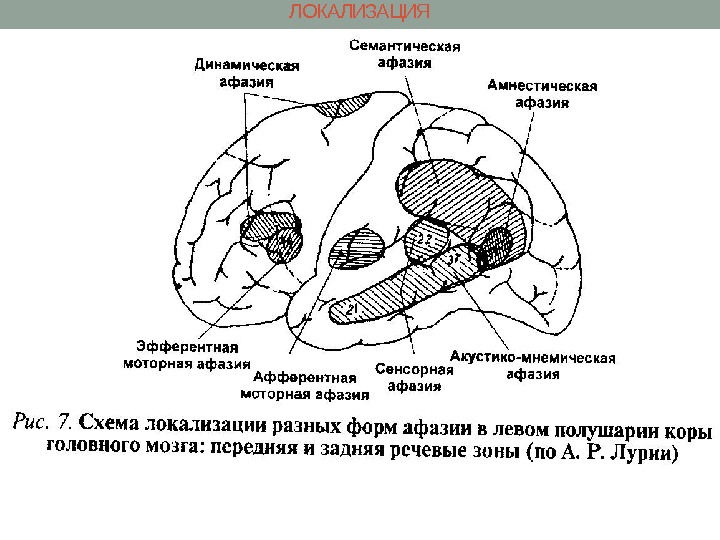 ЛОКАЛИЗАЦИЯ 