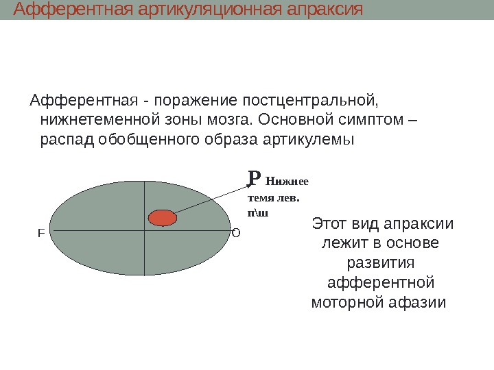 Афферентная артикуляционная апраксия Афферентная - поражение постцентральнои,  нижнетеменнои зоны мозга. Основнои симптом –