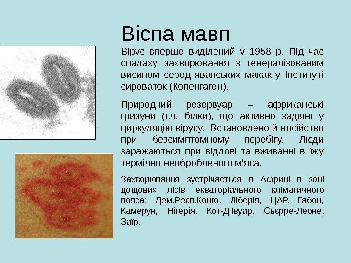 Віспа мавп Вірус вперше виділений у 1958 р.  Під час спалаху захворювання з