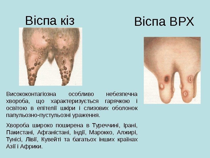 Віспа кіз Віспа ВРХ Висококонтагіозна особливо небезпечна хвороба,  що характеризується гарячкою і освітою