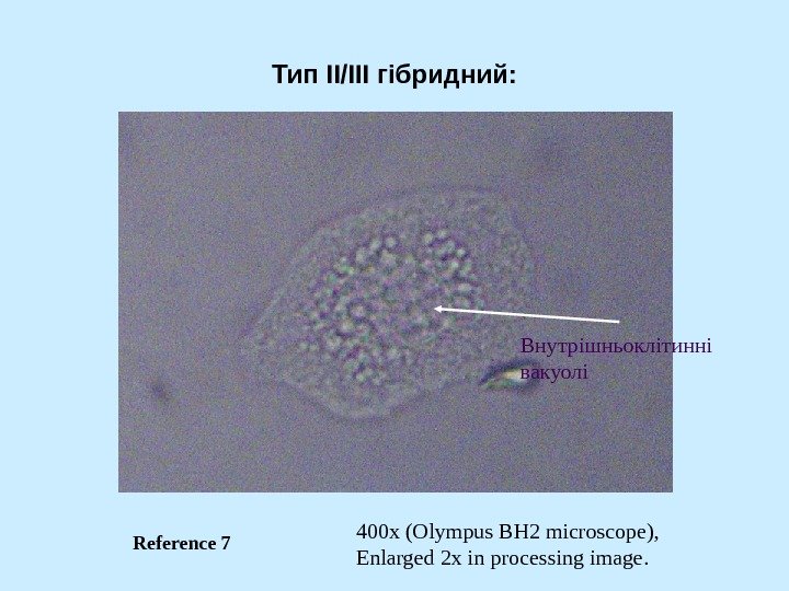   Тип II/III гібридний : 400 x (Olympus BH 2 microscope), Enlarged 2