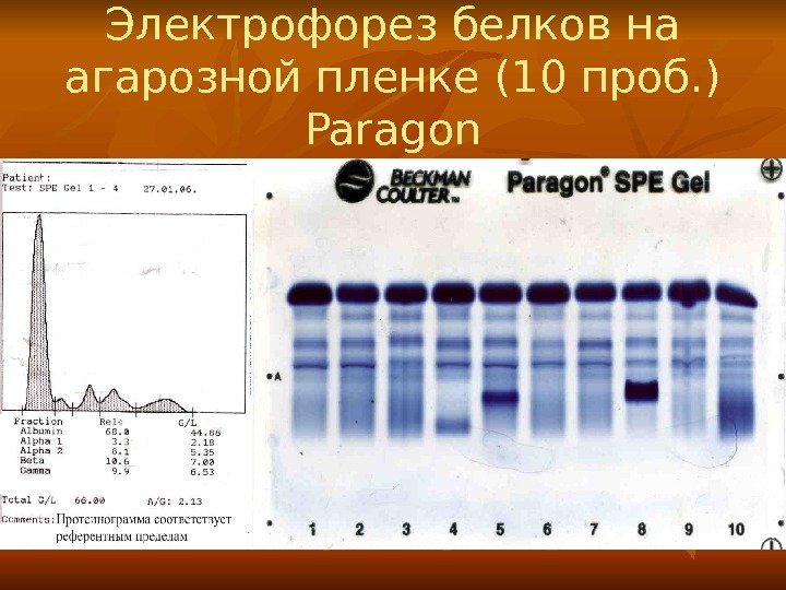Электрофорез белков на агарозной пленке (10 проб. ) Paragon 