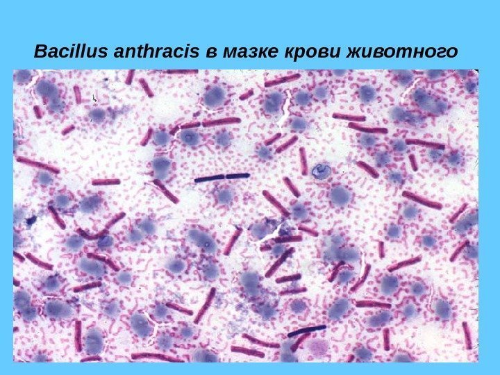 Bacillus anthracis в мазке крови животного  