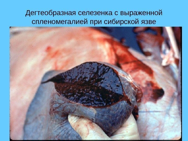 Дегтеобразная селезенка с выраженной спленомегалией при сибирской язве 