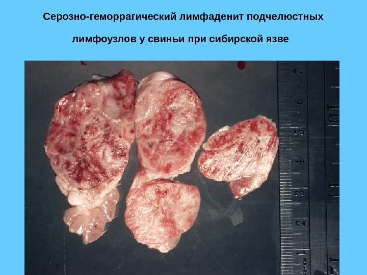 Серозно-геморрагический лимфаденит подчелюстных лимфоузлов у свиньи при сибирской язве  
