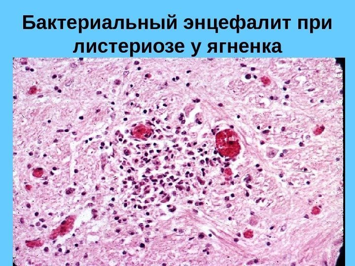 Бактериальный энцефалит при листериозе у ягненка 